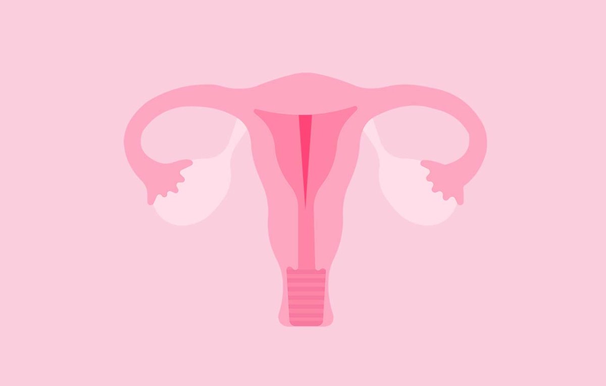 imagem mostrando um útero com uma divisão no seu interior representando o septo uterino